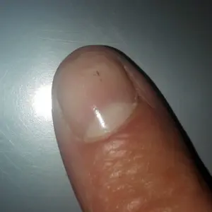 Лейконихия белые пятнышки
