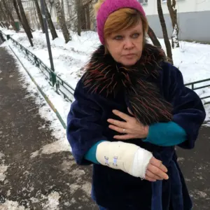 Зимняя одежда со сломанной рукой